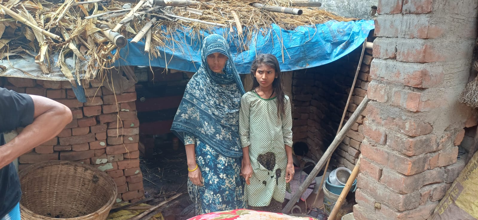 भीषण आग से गरीब परिवार तबाह, 10 वर्षीय बच्ची झुलसी