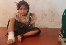 शौचालय की छत का पटिया गिरने से 7 वर्षीय बच्ची गंभीर रूप से घायल, 25 टांके लगे