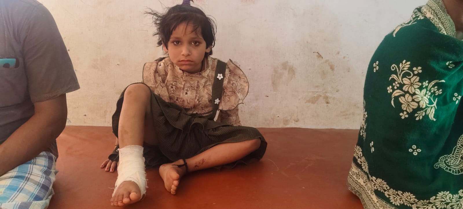 शौचालय की छत का पटिया गिरने से 7 वर्षीय बच्ची गंभीर रूप से घायल, 25 टांके लगे